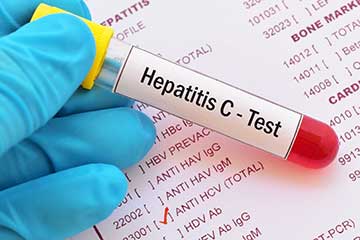 Prueba de hepatitis C